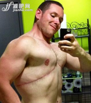 蜗牛扑克:惊呆了!美国胖男两年减掉92公斤